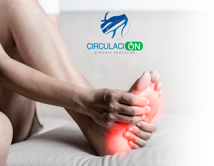 tratamiento de ulceras varicosas cdmx